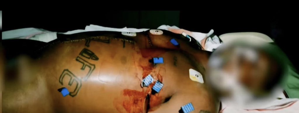 ChaosLensX's tweet photo. New leaked photo of legendary American rapper Tupac Shakur during autopsy, 1996. The famous rapper was shot four times after a Mike Tyson fight in Vegas but succumbed to his injuries seven days later. https://t.co/DA5ZS0ILYY