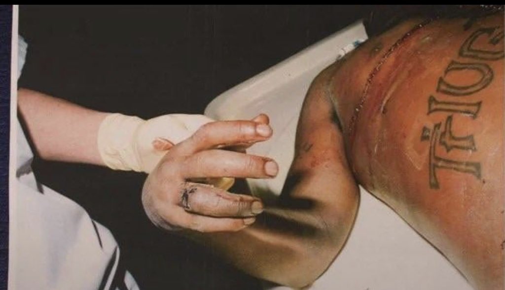 ChaosLensX's tweet photo. New leaked photo of legendary American rapper Tupac Shakur during autopsy, 1996. The famous rapper was shot four times after a Mike Tyson fight in Vegas but succumbed to his injuries seven days later. https://t.co/DA5ZS0ILYY
