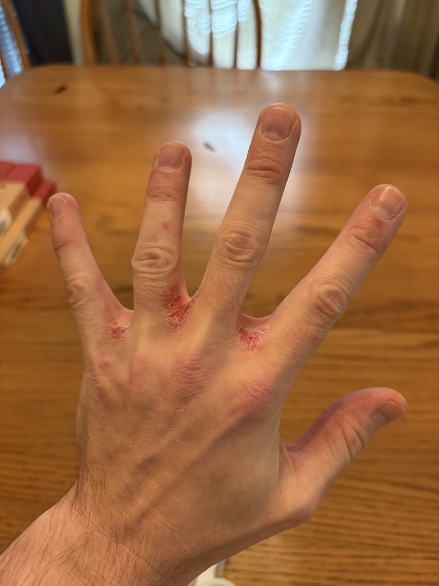 math_mgcn_v37's tweet photo. Consequences https://t.co/2q0EkLf973