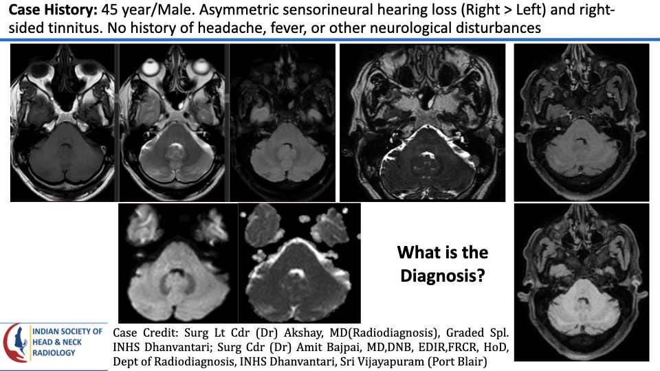 teamishnr's tweet photo. #caseoftheweekanswer

Please find the answer
#radiology #caseoftheweek #headandneck #radiologycases #dailywork #ISHNR #teaching #research #imaging #FOAM #FOAMRad #FOAMMed

Visit our website: https://t.co/tVYnQC3iEs
All Cases: https://t.co/0xaPvoBy5H https://t.co/fmjngY0xP7