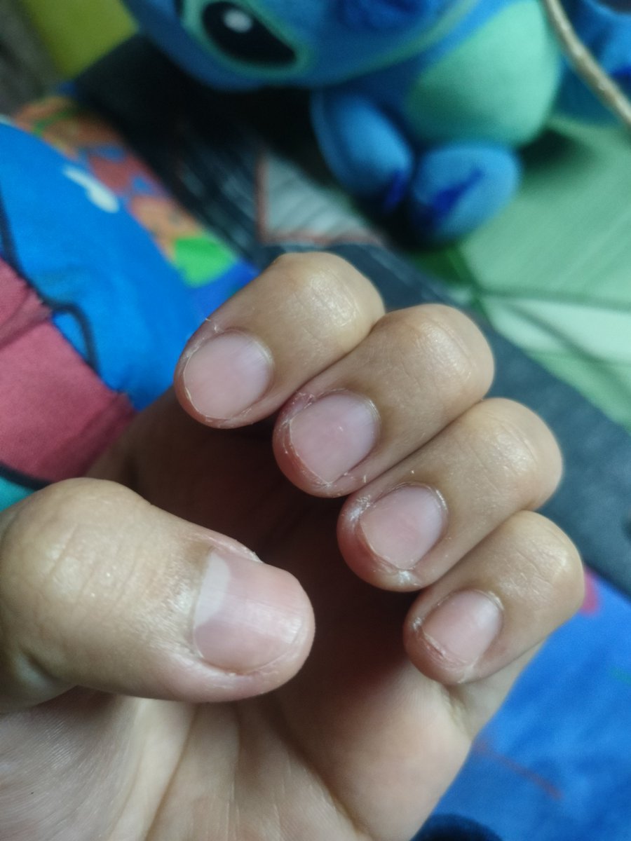Ashellll's tweet photo. Need kona sila putputin para wala nako ngatngatin WHAHAHAHAHA https://t.co/rsmOyR71nT