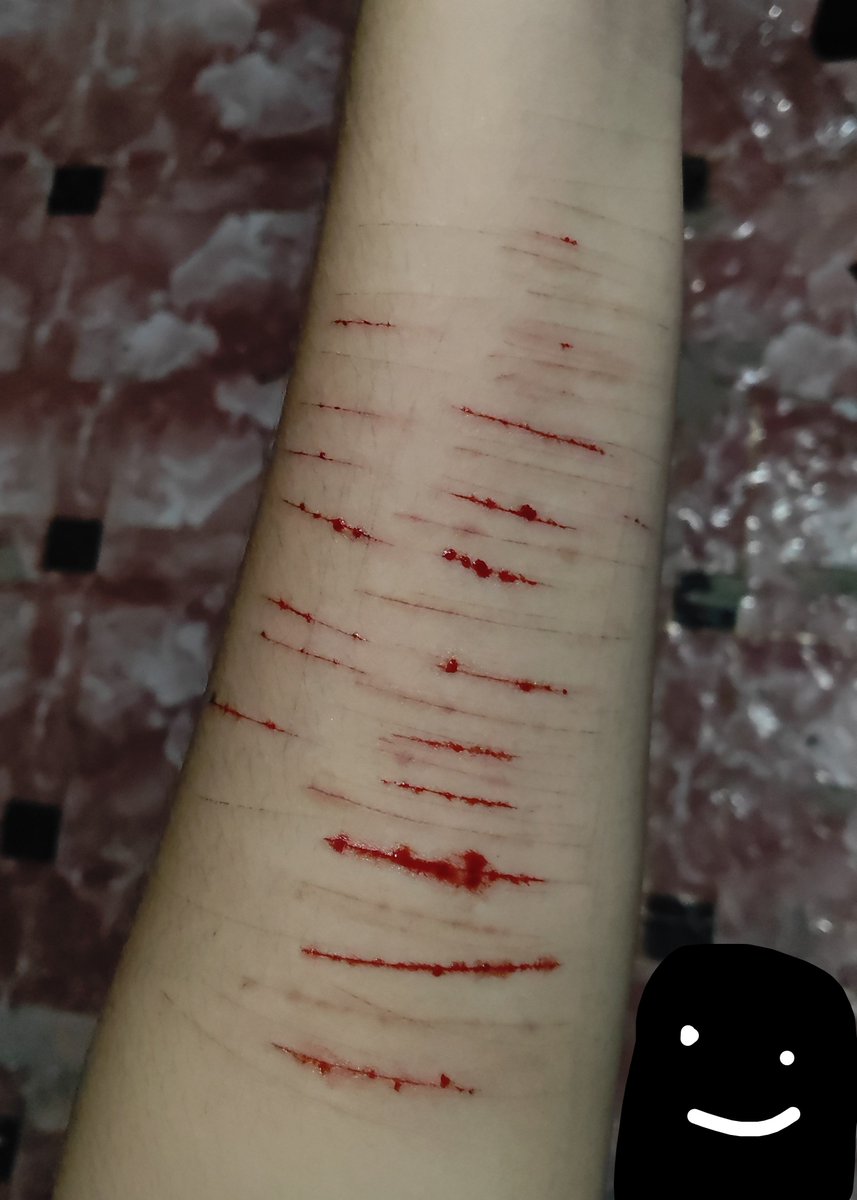 Altshtwx's tweet photo. ALL FAKE ! FAKE BODY ! ARTIFICIAL BLOOD ! VFX ! FAKE AI GENERATED HALLOWEEN MAKEUP
New cvts! (ignore pablo) #shtwt #shtw #vent #ventwt #ventw #cuts #cutter #cutters https://t.co/2vFxS9XuXZ