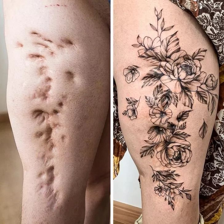 TacitusChrono's tweet photo. I love how the flowers work with the scar instead of simply hiding it. Such a thoughtful way to turn something personal into a beautiful piece of art. https://t.co/8dAJl0FkSr