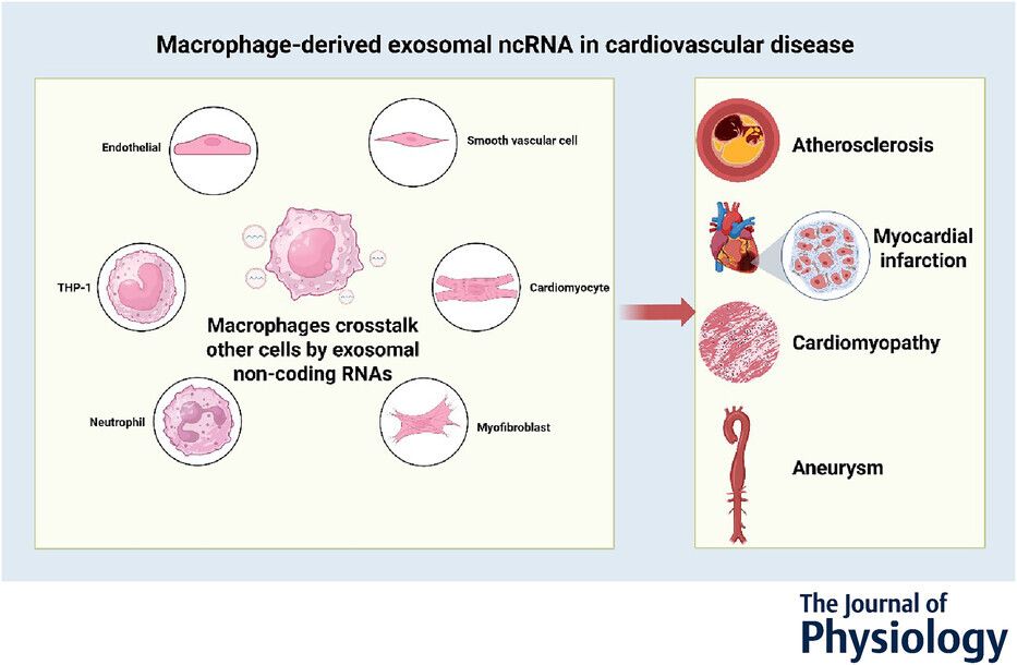 JPhysiol's tweet photo. In this recent review, Wenyan Ding and colleagues examine the role of non-coding #RNAs derived from macrophage exosomes in cardiovascular #diseases 🫀 🔎 

Read the article👇️ 
https://t.co/4UQQwYFO5D https://t.co/jmjZvQbvD3