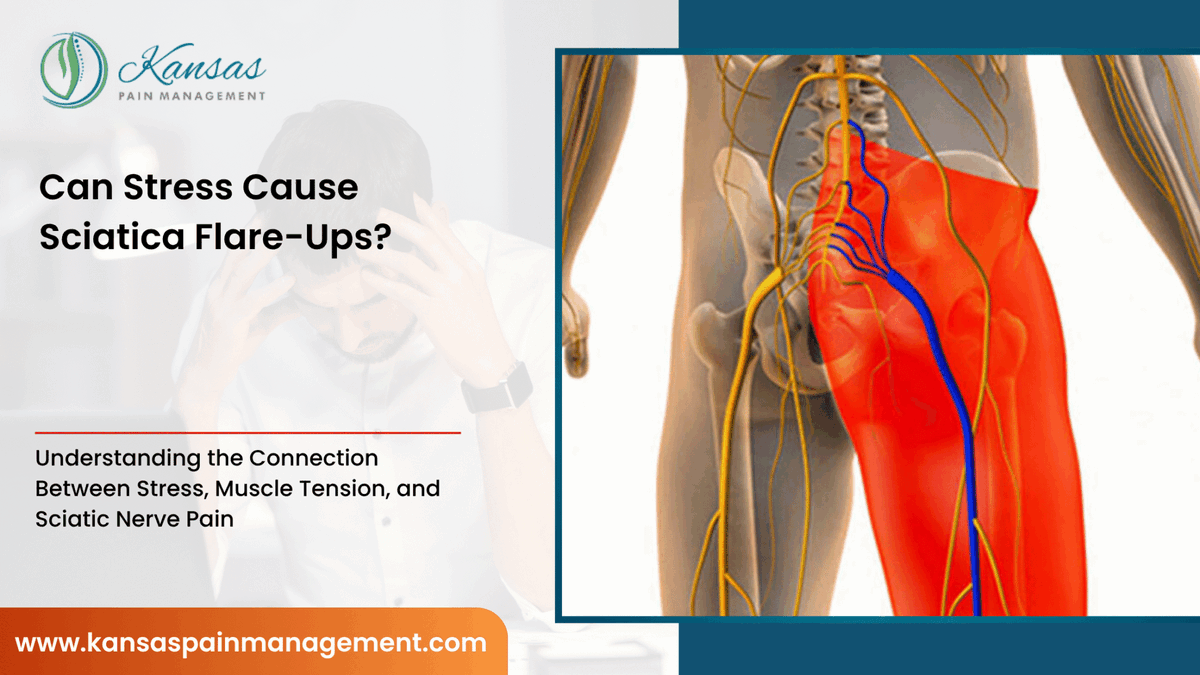 KansasPain's tweet photo. Many patients associate sciatica solely with a pinched nerve or herniated disc. While structural issues can certainly contribute to sciatica, emotional stress may also play a significant role in how pain is experienced.
Read more https://t.co/A37DYurJJi https://t.co/nQwdesm4GC