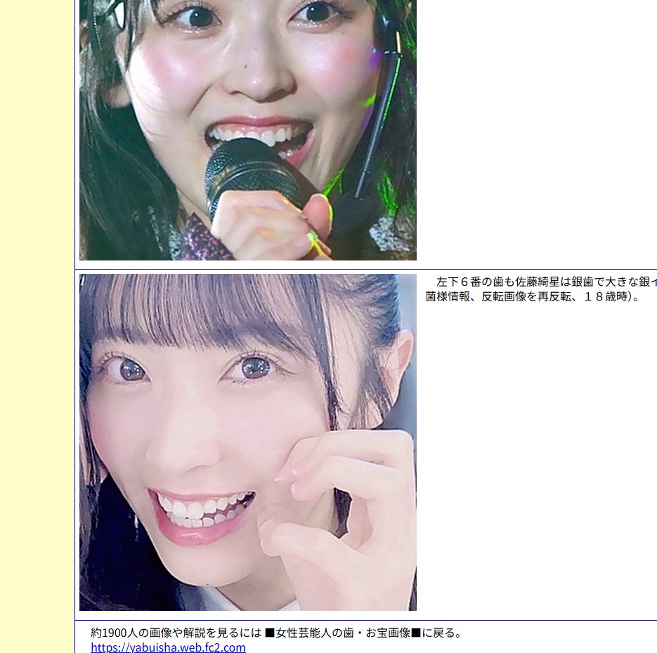 KeygegenMX's tweet photo. あらゆる女性タレントの歯（銀歯など）に関する写真付き詳細なデータベースのサイト、たまに見ると笑うなぁｗ
国民的女優となった橋本環奈さんから、トップ女性声優の高橋李依さん、AKBの顔となった佐藤綺星さん、185キロ追突事故の永野芽郁さん？
『女性芸能人の歯』でググると、そこはフェチの世界！ https://t.co/Yg9HocLCCL