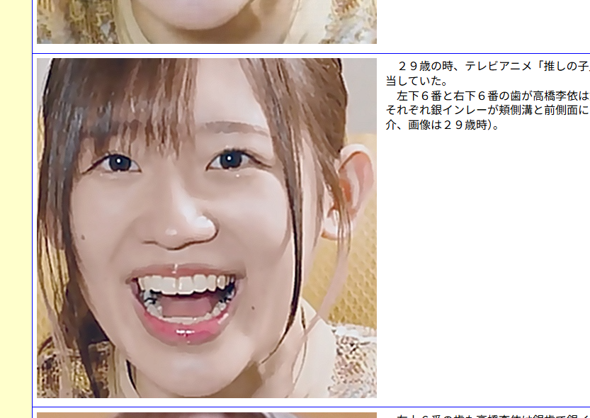 KeygegenMX's tweet photo. あらゆる女性タレントの歯（銀歯など）に関する写真付き詳細なデータベースのサイト、たまに見ると笑うなぁｗ
国民的女優となった橋本環奈さんから、トップ女性声優の高橋李依さん、AKBの顔となった佐藤綺星さん、185キロ追突事故の永野芽郁さん？
『女性芸能人の歯』でググると、そこはフェチの世界！ https://t.co/Yg9HocLCCL