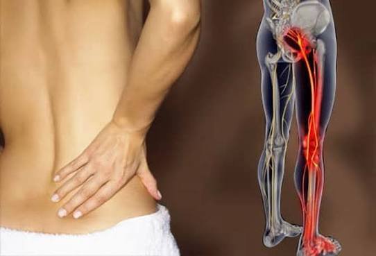 CallahanCares's tweet photo. Sciatica: What You Should Know 🧵
Sciatica is a term used to describe symptoms that involve the sciatic nerve, often causing discomfort that can travel from the lower back or buttock into the leg. https://t.co/ObiPmkwGV5