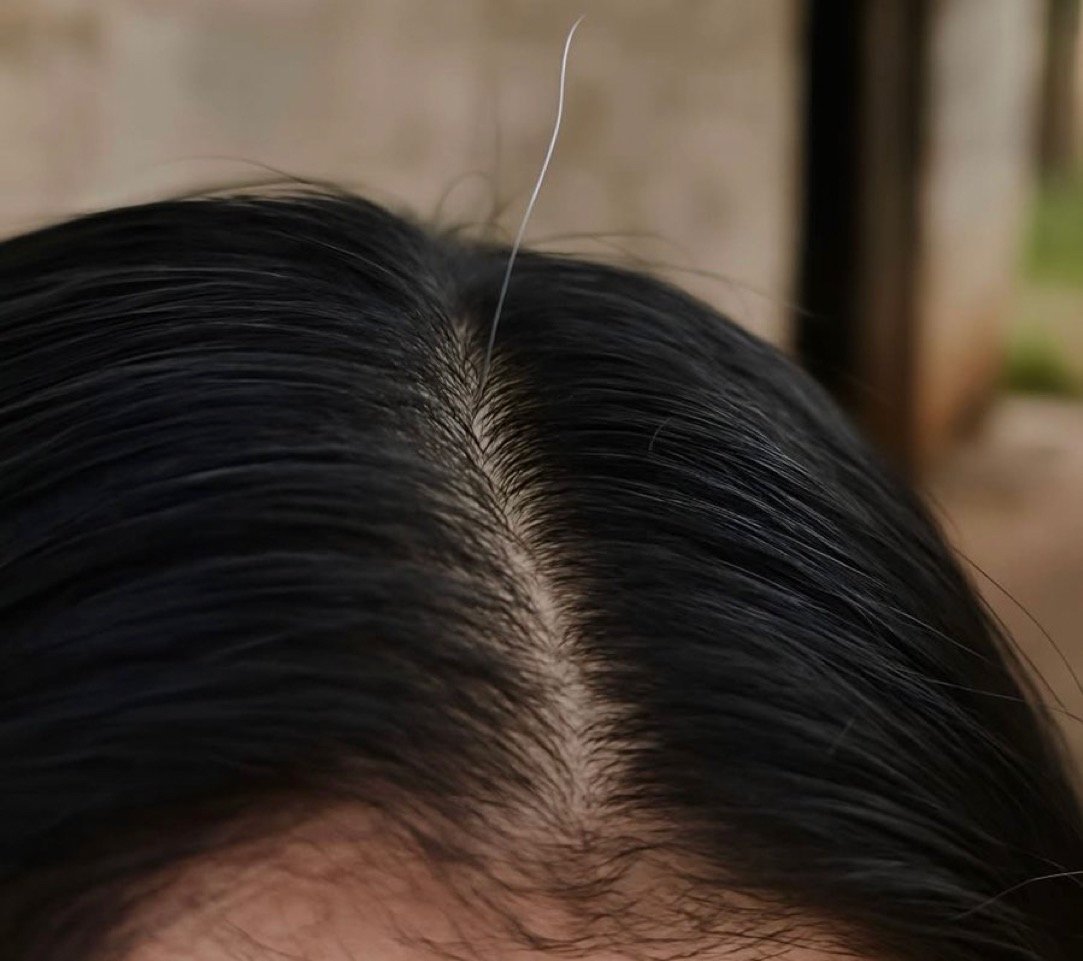 Guarromantico_'s tweet photo. Yo: aferrándome a la juventud

Mis canas levantando bandera: https://t.co/hD7TtfN33H
