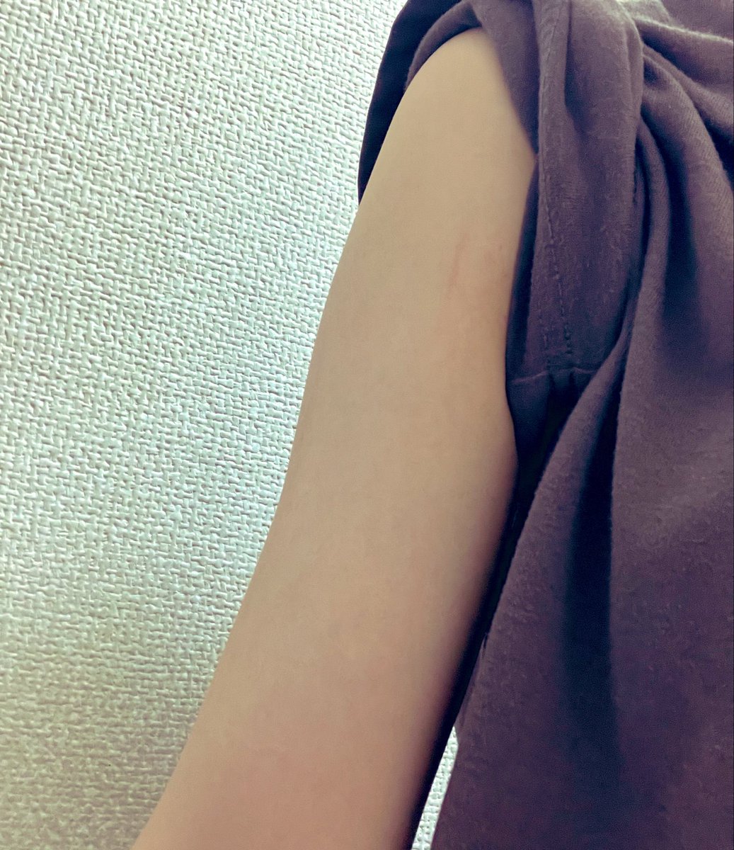 zff35061's tweet photo. 右腕と、左腕。
なんかとても左腕に申し訳なくなってきた。
ごめんね。
 #リスカ https://t.co/Paal4Rl1TY