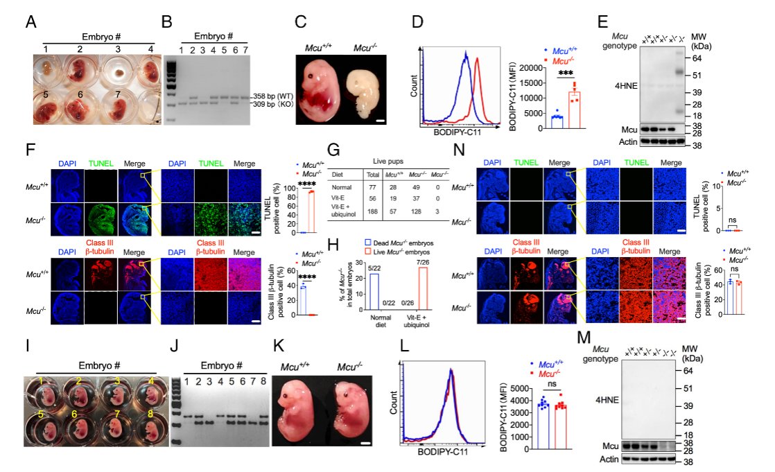 OhioStatePIIO's tweet photo. New research in @PNASNews reveals how deletion of the mitochondrial calcium uniporter (MCU) in #cancer cells boosts #anti_tumor #Tcell responses and slows tumor growth, highlighting a promising new target for #cancer_therapy. Congrats to #PIIO members @anjunma90, @GangXin1, Kai He, Bei Liu, @QinMaBMBL , @Zihai Li, and @wen_haitao! 🔬🧬
📖 https://t.co/deiQGI6WVW
