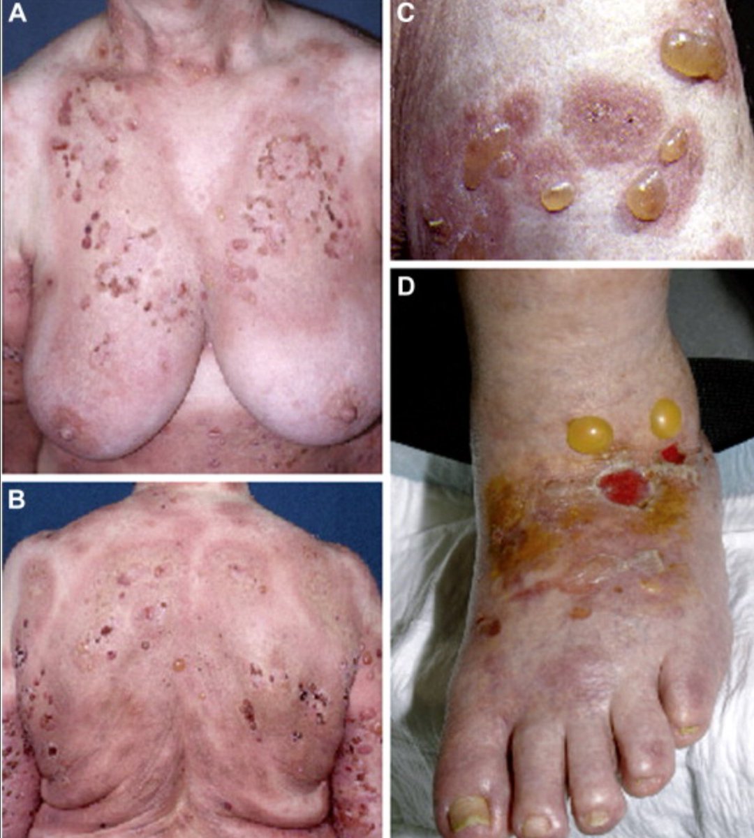its_faiz_here's tweet photo. Painfull write diagnosis of this ? https://t.co/x3T8OWBngA