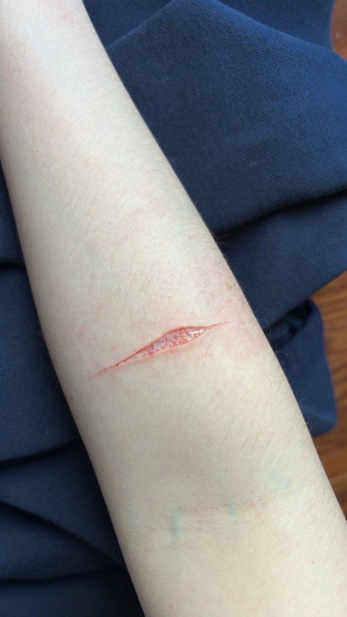 kitbandage's tweet photo. im so mad bc i just did weak ass cuts when ive literally done this before no ice just swipe im UGHHHHH https://t.co/C91E06TfKA