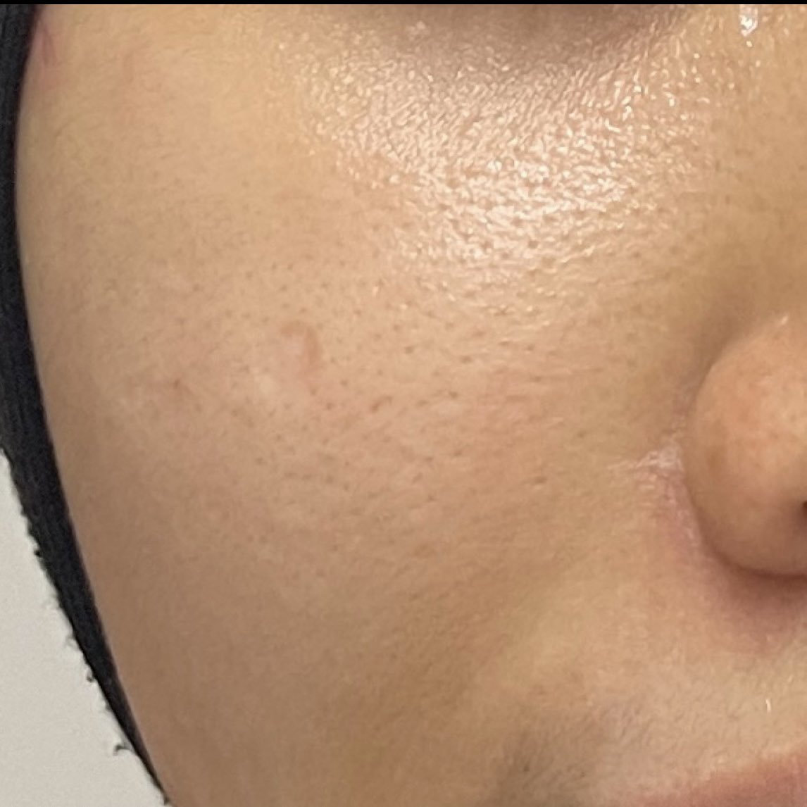 pretty3ll's tweet photo. 3. Last sekali, moisturizer. I guna ni https://t.co/uQjsrQjlo4
texture ringan, tak rasa berat &amp; tak mudah buat kulit clogged. Kulit pun rasa lebih hydrate. https://t.co/5AbwgPqXJw
