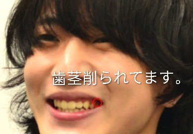haruma11111's tweet photo. #HelloHello✋️#たくみ🥁君の体調不良は望んだ事ではなく🥁は
歯科に通ってました
私は健康な歯歯茎歯肉削られ🦷る犯罪に遭い
虫歯歯周病にされ菌周り👿緊急搬送
🦷👿体調不良ある為被害者大勢いる為
今日のたくみ君脱退LIVE薦https://t.co/HriNNKDYCV✋️音楽続ける為🥁回復頑張る為今後も応援改善🙇♀️ https://t.co/gS7voIRigC