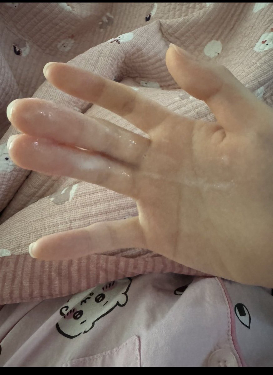 yebin0000000's tweet photo. 어질어질 https://t.co/MTatAApjMs