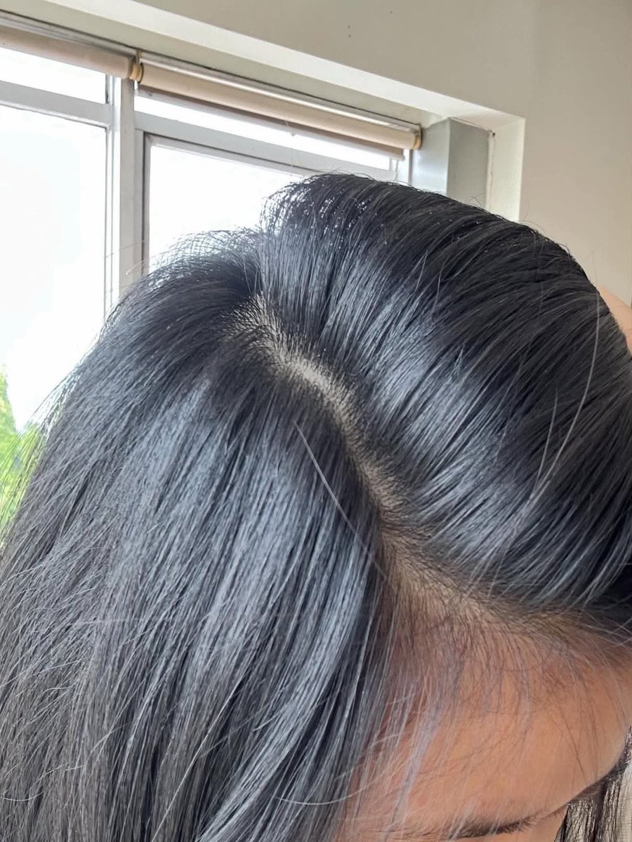 nadaeladela's tweet photo. Kemaren aku liat ada bayi kepalanya di marinasi, aku iseng ikutan🥹 ternyata di bayi bangkotan ternyata juga sengaruh itu￼ https://t.co/bstwc3pkiy