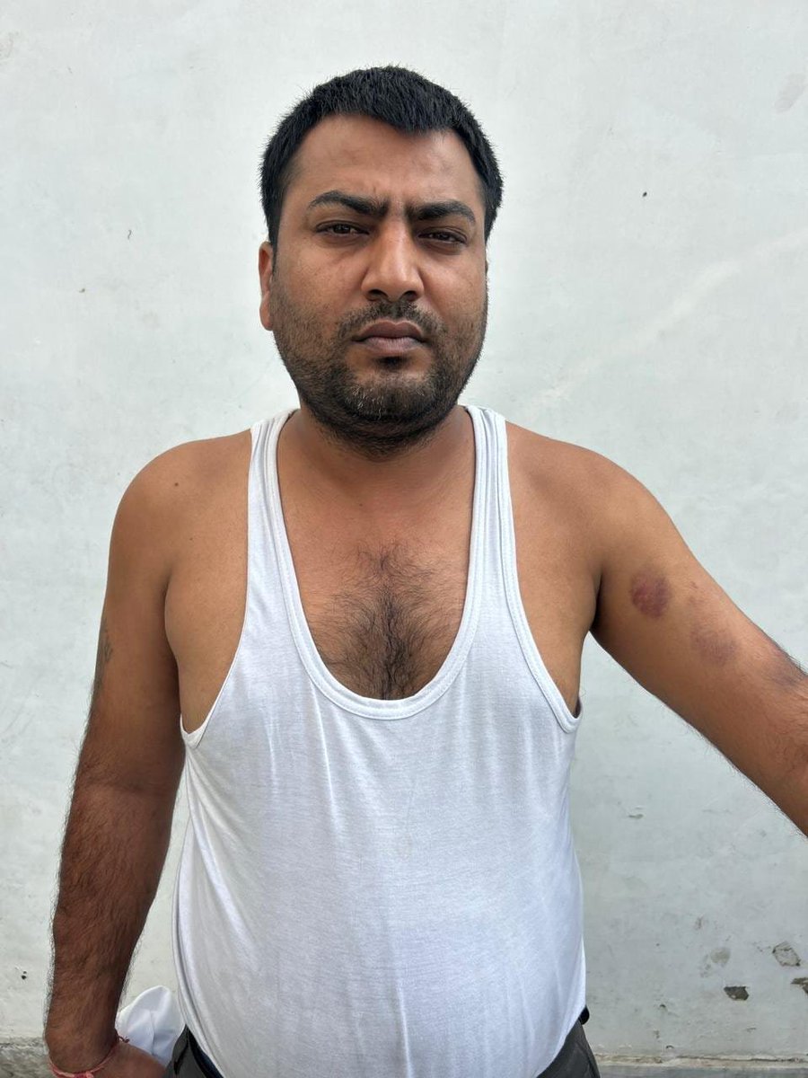 BhimArmyChief's tweet photo. मेरठ में मोहित जाटव और दिग्विजय भाटी के साथ पुलिस हिरासत में हुई बर्बरता कानून-व्यवस्था और पुलिस की जवाबदेही पर गंभीर सवाल करने वाली हैं।

पीड़ितों का आरोप है कि तत्कालीन SSP अविनाश पांडेय ने दोनों को अपने कार्यालय बुलाकर गालियां दीं और चैंबर बंद कर उनके साथ मारपीट की। इसके बाद SOG के हवाले कर उन्हें पैर बांधकर उल्टा लटकाने और फट्टों-लाठियों से बेरहमी से पीटने का भी आरोप है।

मुख्यमंत्री @myogiadityanath जी, यह पुलिसिंग नहीं, बल्कि वर्दी की ताकत का खुला दुरुपयोग और हिरासत में यातना है। किसी भी अधिकारी को कानून अपने हाथ में लेने का अधिकार नहीं है।

@UPGovt तत्काल CCTV फुटेज सुरक्षित कराए, पीड़ितों का स्वतंत्र मेडिकल परीक्षण कराए और आरोपों की निष्पक्ष जांच सुनिश्चित करे। दोषी पाए जाने वाले अधिकारियों के खिलाफ कठोर कानूनी कार्रवाई हो।

वर्दी कानून से बड़ी नहीं है और आम नागरिकों की आवाज को पुलिसिया ताकत के बल पर दबाना किसी भी कीमत पर स्वीकार नहीं किया जा सकता।
@India_NHRC