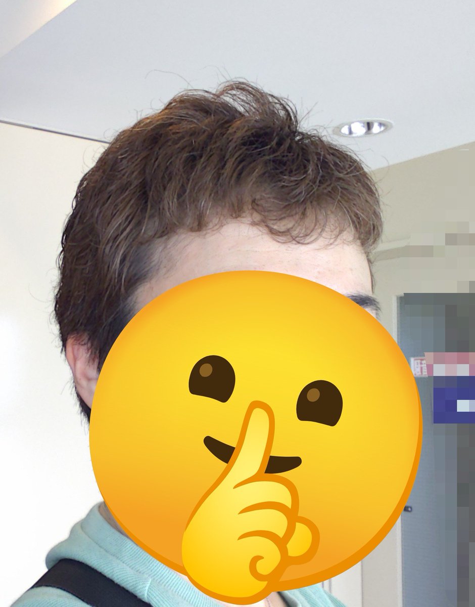 narutsumu's tweet photo. TC療法⑥２４６日目。ラスケモから8ヶ月。手足の痺れはストレスかかった時にチクチクする程度。普段は感じない。だからメチコバールだけ貰ってきた。髪は相変わらずこんな感じ。通院デーはご褒美デー。でも最後に凶が出た。凶が多いことで有名なところ。その他大勢は実は強いと思ってる。
#抗がん剤 https://t.co/8r7IHvH4Ko
