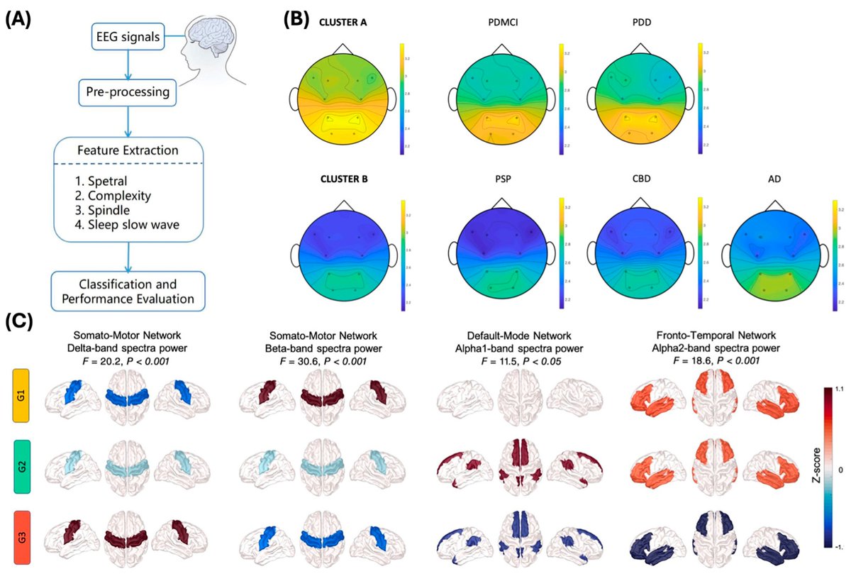 Biosensors_MDPI's tweet photo. 📣Call for Reading:
#Editor_Choice #Review
Development of #Neurodegenerative #Disease #Diagnosis and #Monitoring from Traditional to Digital #Biomarkers
By Kim, J. et al.
https://t.co/YOyEV1Xdfd
#biosensor #open_access #biosensing #biomarker #point_of_care https://t.co/2Yz5rqGCJj
