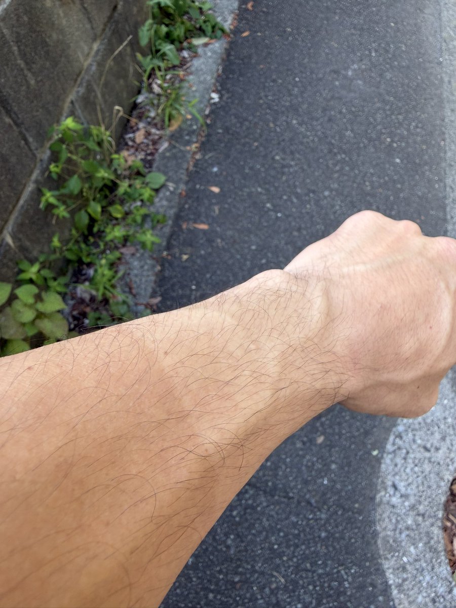 Ultra_Fujitani's tweet photo. 炎天下のコスサミでサガットをやった結果
胴体と腕に特殊な日焼けができました
多分数ヶ月はこのままです
アイガー！ https://t.co/6kIfr0BuLb
