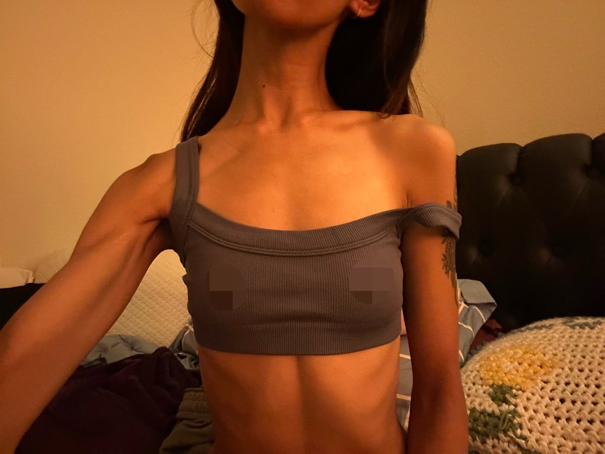 witheringfemme's tweet photo. post 2k cals today holy fohhhh 😭 i def gained but im dedicating today to sunday to losing ^.^!! 

anyone else’s veins be popping like this tho? is it just low bf%?

#edrtwt #thinspo #bodyfat https://t.co/8BmMvBijyq