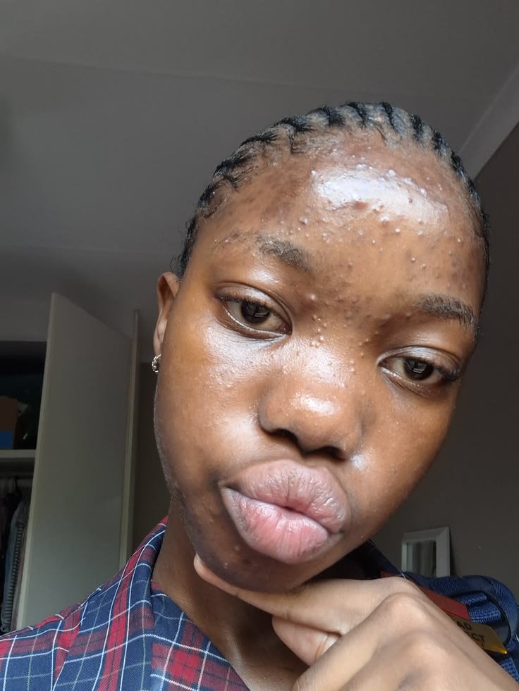 slym_mama's tweet photo. Some people don't even have sexy lips abeg watin be dis🤦 https://t.co/Ua8S3qObmU