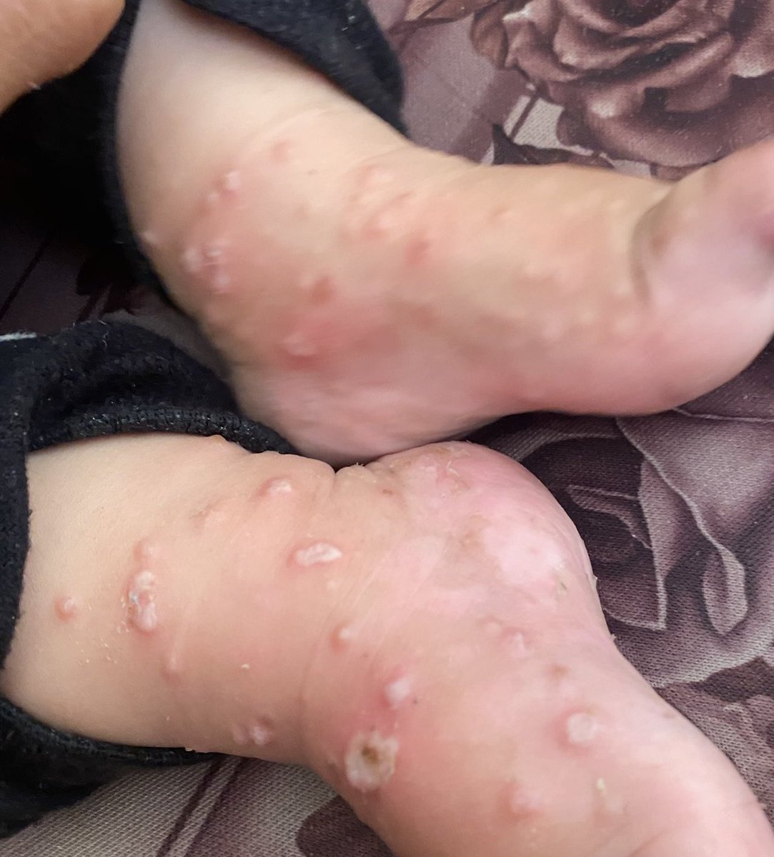 hazemkhilla's tweet photo. I BEG YOU😭

Stop please😭

My child is dying😭

Don't ignore

beg you

 Help me

I need milk

beg you

Help me

I need MILK 

I need MILK

I need MILK

I need MILK

BEG YOU 

I need MILK

I need MILK

I need MILK

I need MILK

I need MILK

Help me😭

https://t.co/ZA6ngSZBuj https://t.co/SFHiCvcRL3