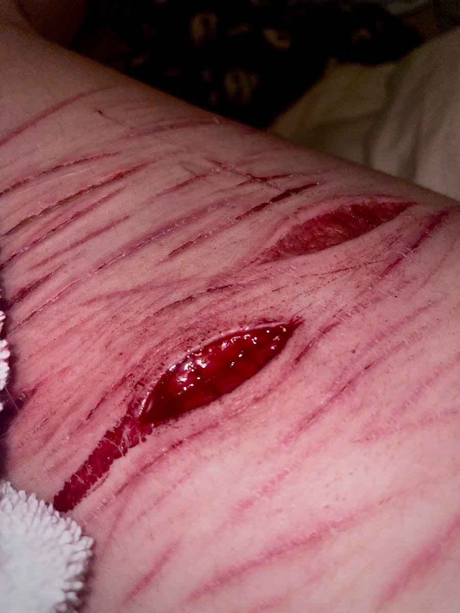 JaneCarter93093's tweet photo. SFX makeup! Love it, love it, love it
#sfxmakeup #sharmtwt #shtwt https://t.co/1qAlbl97Nd