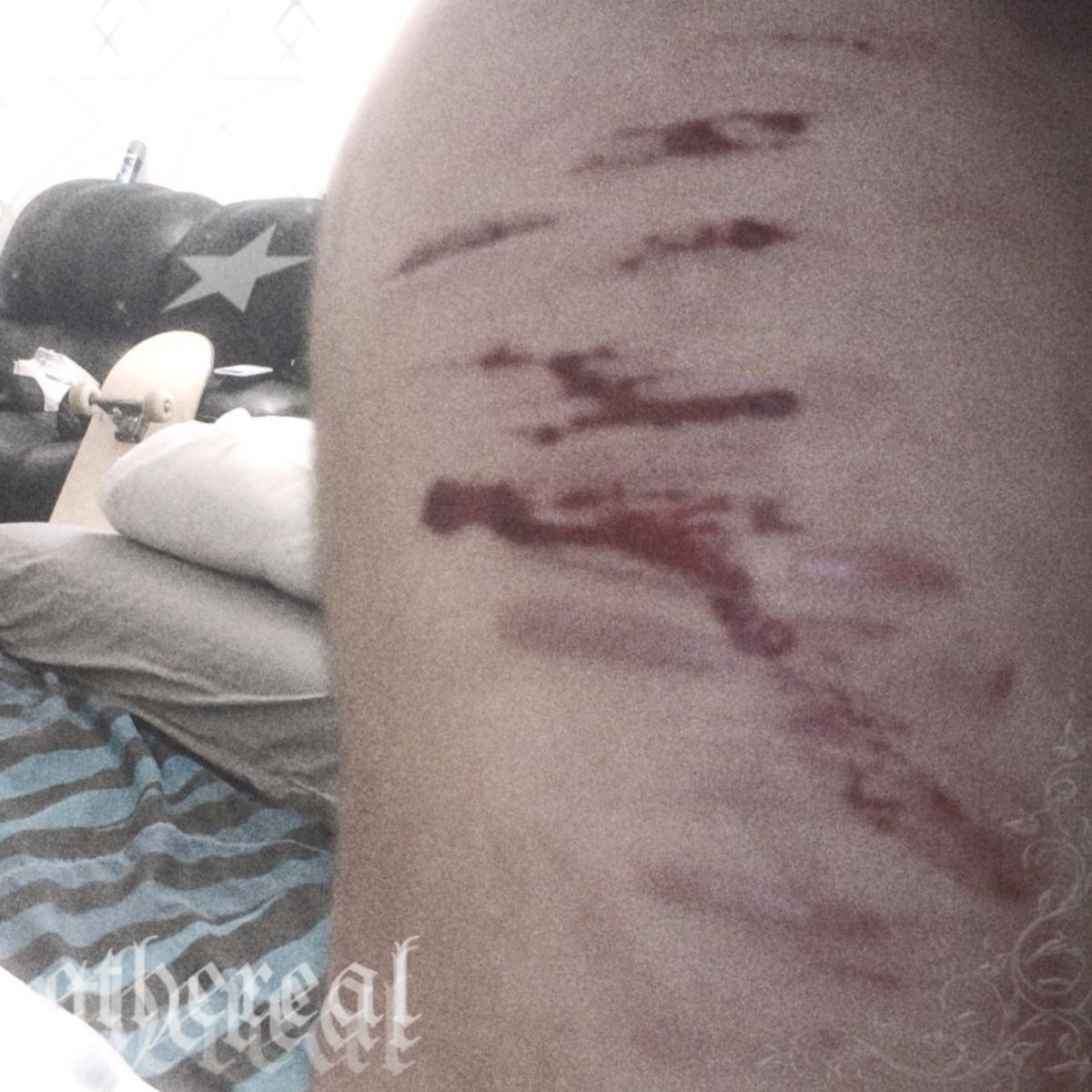 3li_eli_1's tweet photo. AI SFX MAKEUP

sigh only cat scratches
MOOTS ANYBODY?

#slitwt #shtwt #988twt #moots #sfxmakeup https://t.co/dmU9NDbgY8