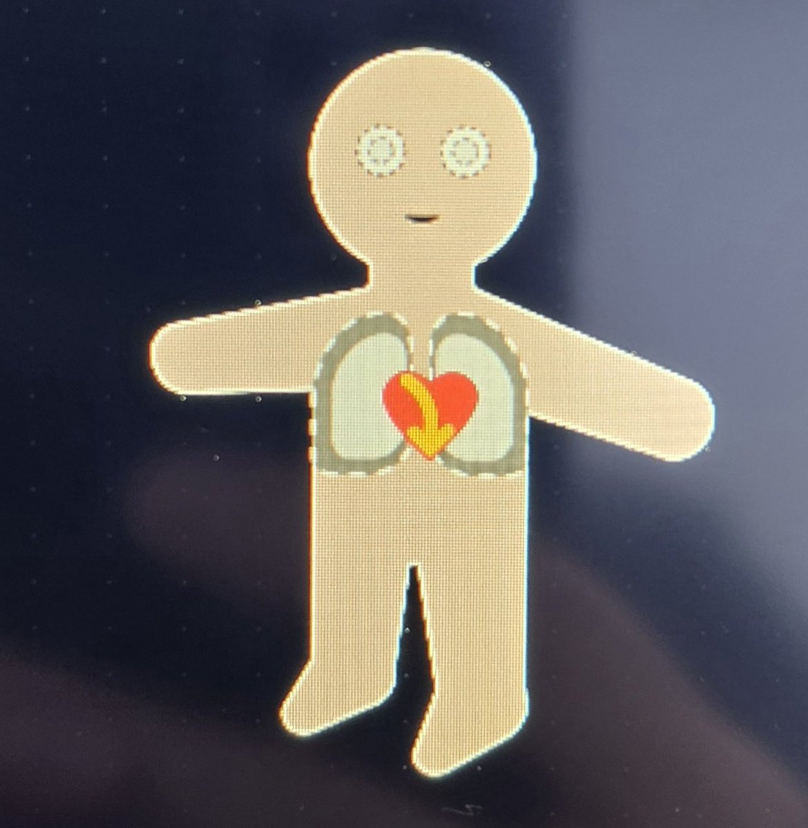 DrPokeAnestesia's tweet photo. Razones para tratar la hipotensión:

1. Es lo correcto ❌ 
2. Para mamasear ❌ 
3. Para que el monito de la Anestesia esté feliz alv ✅

Mírenlo, está feliz el hdp 🥹❤️ https://t.co/K0xzfGD7tH
