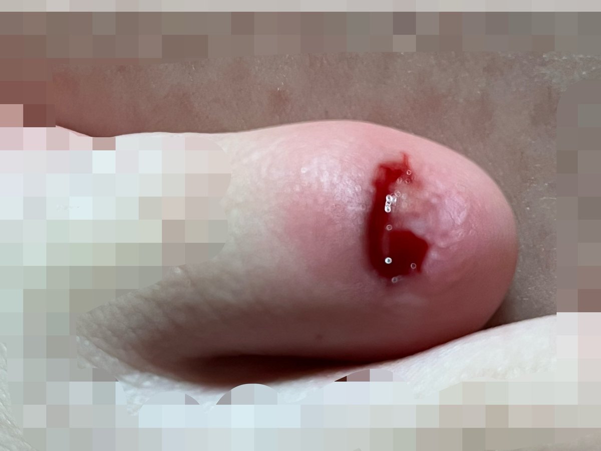 vh96405's tweet photo. もう噛む爪なくて死ぬ
爪って多分薬物と同じ成分入ってる
やめられないもん
まじ食って見て欲しい https://t.co/sJm2hpOCmC