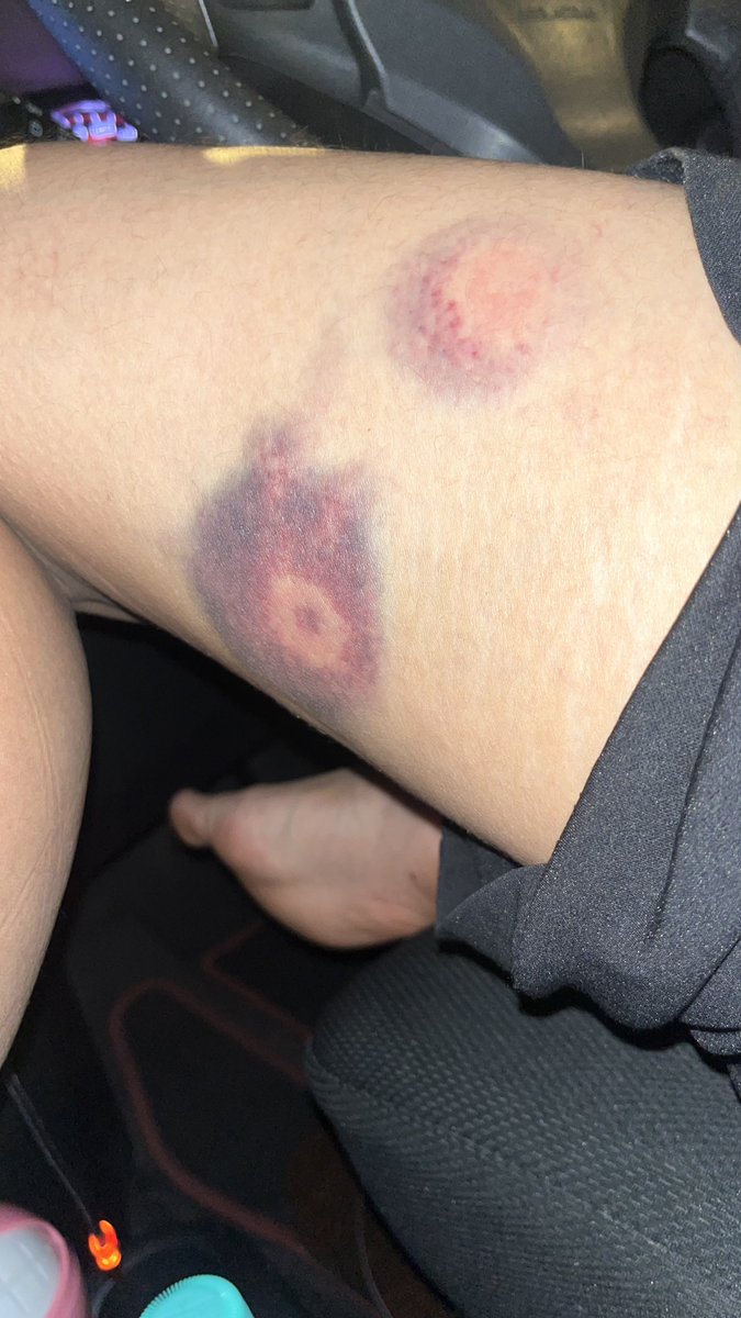 hanshlim_'s tweet photo. The art of being smacked down. Hurt like a bitch https://t.co/Q9hyrUOHaP