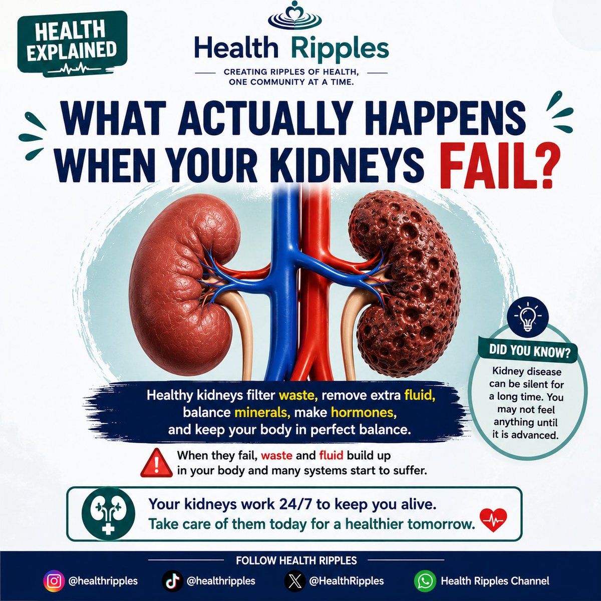 HealthRipples's tweet photo. 🔥What Actually Happens When The Kidneys Fail?

When kidneys lose ability to work properly, waste and excess fluid builds up in the body. This also affects electrolytes, blood production, bones &amp; other organs

Kidney failure doesn't affect only kidneys — it affects the whole body https://t.co/6zWPSe9rsx