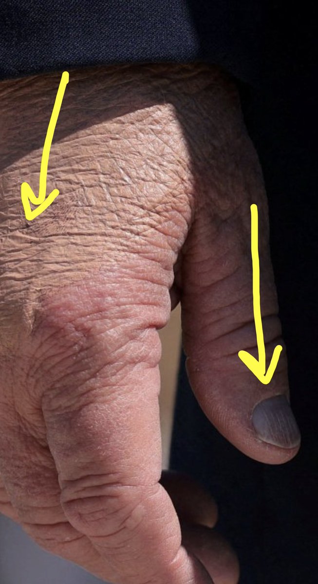 MrJames_G's tweet photo. Thumbnail got more ridges than West Virginia https://t.co/GyVCvrf8gi