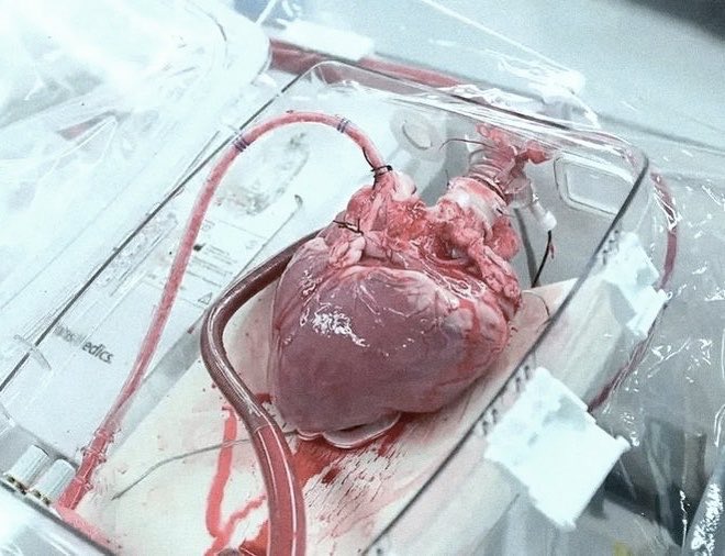 gorednurse's tweet photo. ♡a nurses love goes straight to the heart♡ https://t.co/XnaFe6HJPC