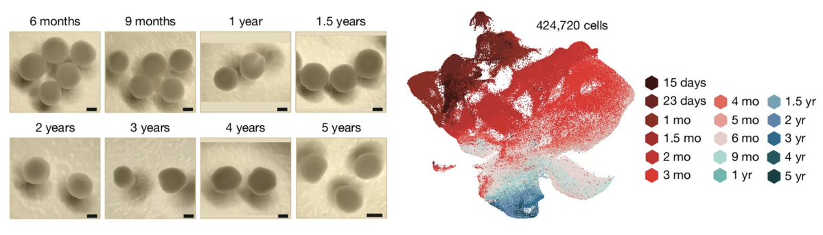 SatoshiYoshiji's tweet photo. Brain organoids, cultured for over 5 years, have a memory from when they were "babies" in vitro.

Extraordinatry study @nature:
https://t.co/ImdWXCQyDk https://t.co/gUqB8CG0KN