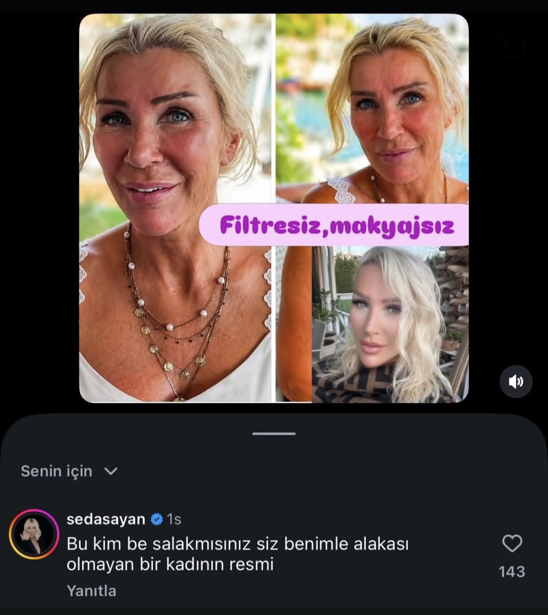 rumicritus's tweet photo. bacim face appsiz fotomu gruba atınca https://t.co/U2J4z6CPo1
