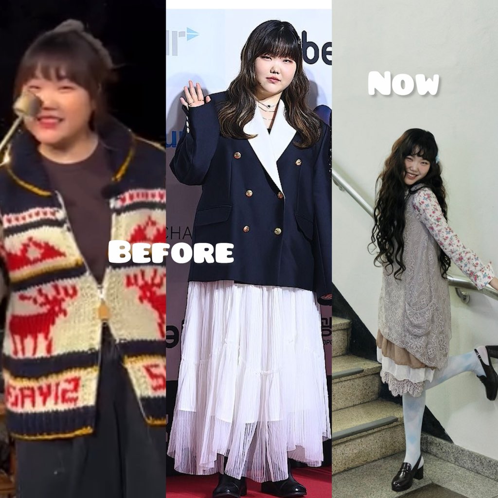 kdramahotgists's tweet photo. It was indeed enough to serve as a huge Wake Up Call 😂😭

AKMU’s Lee Suhyun just revealed something that honestly makes her 30kg weight loss journey hit completely differently.
She admitted that she had been avoiding the hospital because she was terrified of what her health results might say. Then she finally got tested and found out she was already in the pre diabetes stage.
And THIS is why I’ll never understand people reducing celebrity weight loss to  she just wanted to look pretty.😭
Suhyun wasn’t dieting for aesthetics. She was genuinely scared for her health. After that diagnosis, she started exercising, changed her diet and reportedly lost around 30kg over a year.
The most satisfying part? She said her latest health tests came back completely normal. 🥹
What really got me was her admitting that she had reached a point where she didn’t even want to weigh herself because she was afraid of facing reality. That kind of avoidance is so real.
From being scared to even check her health to getting her numbers back to normal… 30kg later, she basically fought her way back to good health.
And honestly, Chanhyuk deserves some credit too because moving in with her and helping her get into a healthier routine apparently played a huge role in her comeback. 😭👏