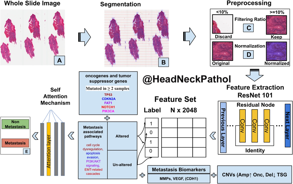 HeadandNeckPath's tweet photo. Predicting Metastatic Potential from Whole Slide Images of Primary H&N SCC Using Attention-Based Deep Learning & Signaling Pathway Alterations
T Majeed, SW Aalam, TA Masoodi et al
https://t.co/5kamdMRr3X
#HeadNeckPathol #HNPJ #HeadandNeckPath #Pathology #ENTPath #PathologyTweet https://t.co/ux2s7bwDHT