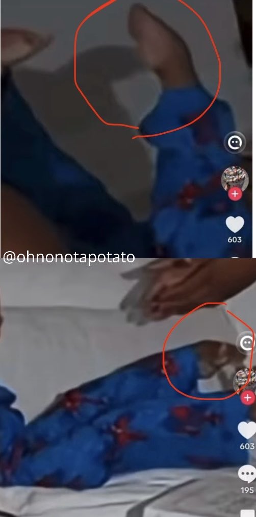 ohnonotapotato's tweet photo. Jr has been neglected so long his clubbed feet now require major surgery to repair. 
Meanwhile @chriseanmalone is laughing at him trying to pull himself up,  stuffing his deformed feet into hard shoes, and lying saying he’s “making progress” as she forces him to stand on his ankles.
Fr #SaveJR
