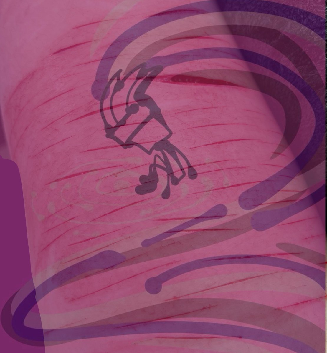 gayintbrush's tweet photo. #shrtwt #shtwt #slittwt #beanstwt #988twt 
Sesh today!! Leg and arm n_n https://t.co/zp2t6dTSln