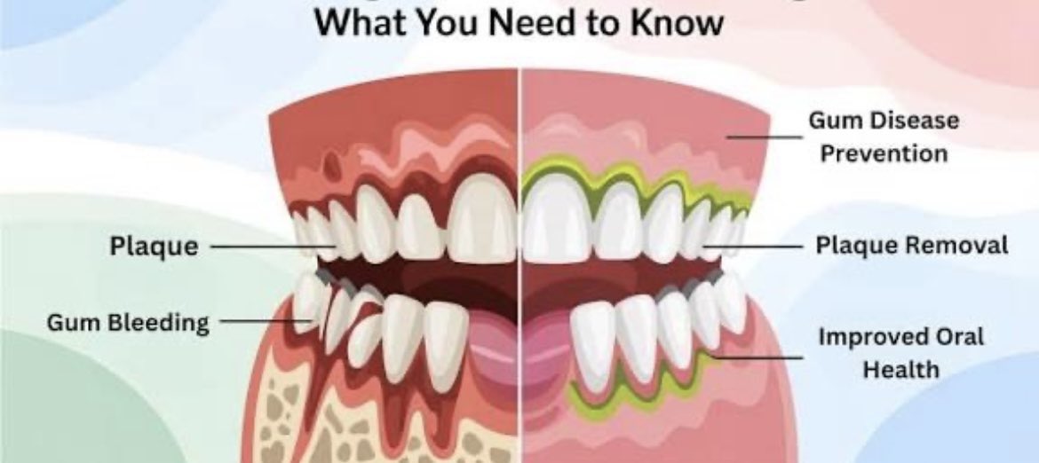 justsmiledc's tweet photo. How patients feel after a Scaling and Polishing appointment 😁 https://t.co/TT2Scjh7t8