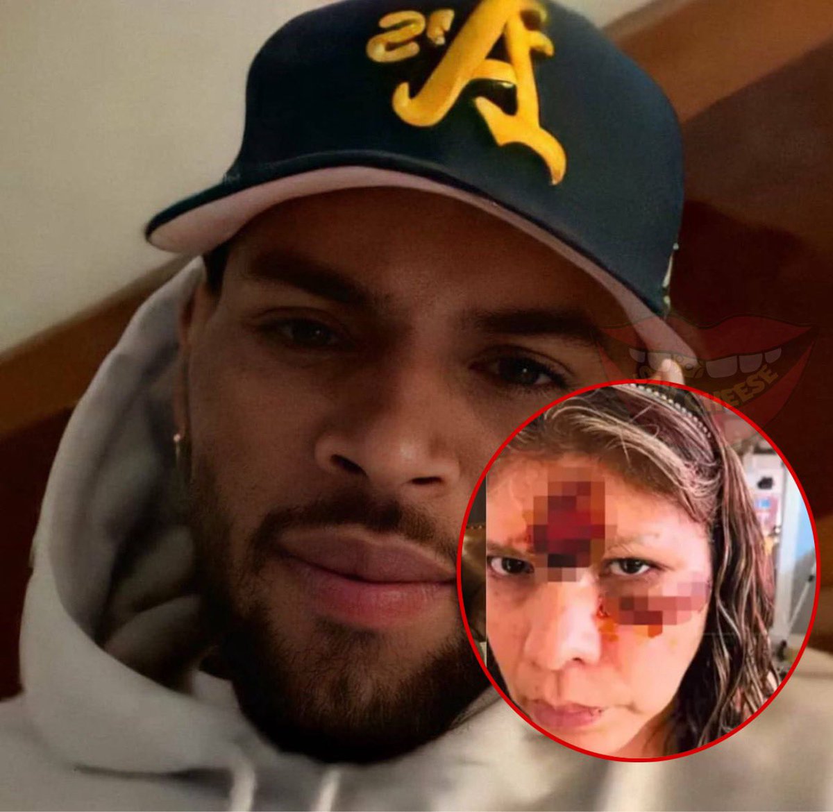 SaycheeseDGTL's tweet photo. Chris Brown’s former housekeeper can now go after his tour earnings after his dog mauled her leaving her permanently disfigured — she was awarded $13M https://t.co/vqxsSfJygN