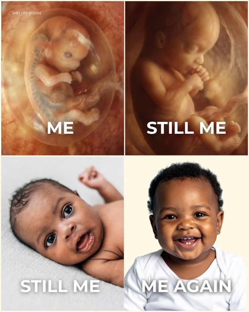 BallotChaser's tweet photo. ✨🔥✨
The size, location, or stage of development never change the value of a precious human being’s life. 👶🧬💖
Like & RT if you agree! 🔥
@TPAction @charliekirk11 @BallotChaser
#fetaldevelopment #humanbiology #biology #alllivesmatter #Babylifebegins #ProLife #TPAction #ChaseTheVote