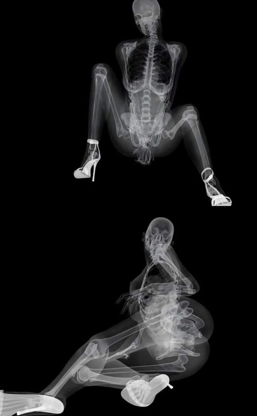 maddyMP3_'s tweet photo. just got my x-rays done, looks like im still that gurl https://t.co/xnjeWG2GaB