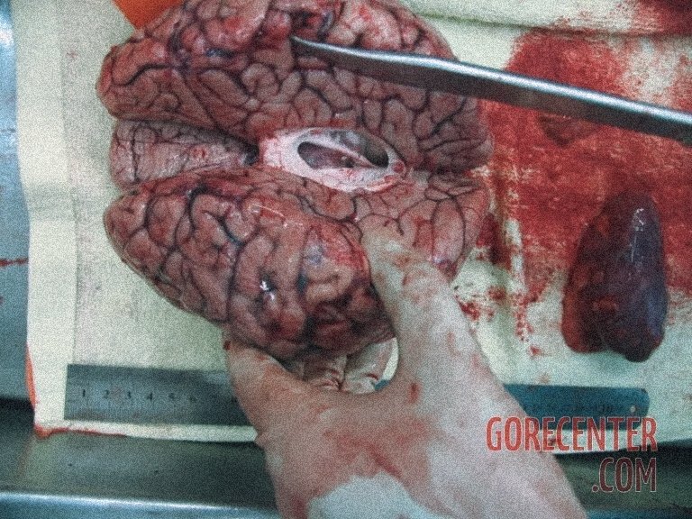mouldiimorii's tweet photo. brain.
ai generated / sfx art https://t.co/3hNkv6o0pY