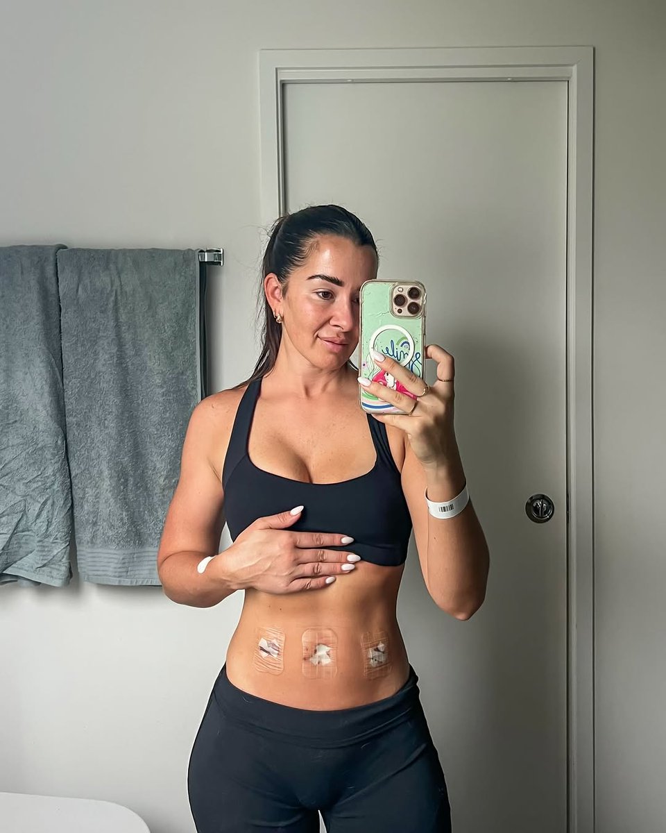 nicolamcphers's tweet photo. *some of these slides contain medical images*
I don’t really have the words to describe how hard the last year has been, but on Friday I had a 6cm tumour removed from my right ovary (non-cancerous), along with endometriosis - and that feels like some... https://t.co/9nQD8swR4x