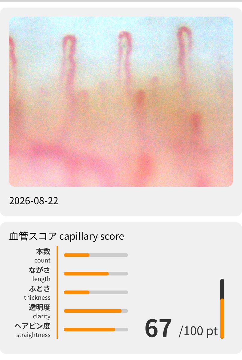 ba_linz's tweet photo. 瘀血がチェックできる(?)機械やってみた👀

指先の毛細血管の太さ、血流を見れてチェック✅ https://t.co/bImdGxP9tE