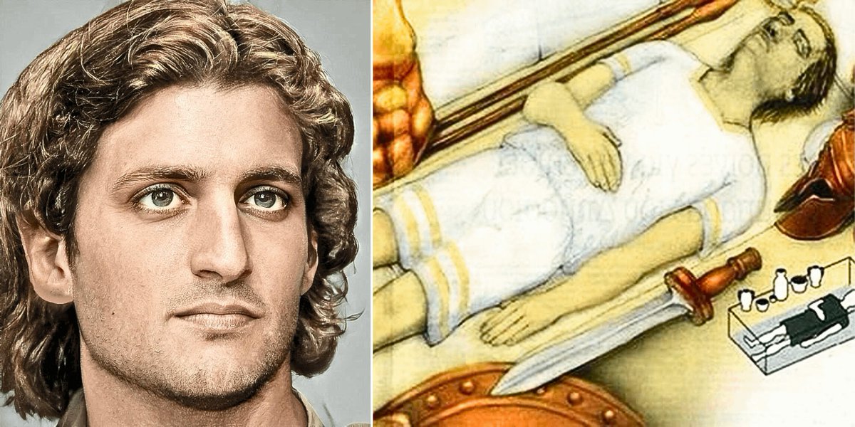 archeohistories's tweet photo. In June 323 BC, Alexander the Great fell ill in Babylon after a night of heavy drinking, suffering from a sudden onset of severe fever, joint pain, and progressive paralysis. 

Over eleven days, his condition deteriorated until he lost the ability to speak and was ultimately pronounced dead at age 32. Ancient accounts record that despite hot summer conditions, his body showed no signs of decomposition for six days following his death. 

Witnesses and followers interpreted this apparent lack of decay as proof of his divinity, solidifying the myth that Alexander was a living god whose mortal remains were immune to corruption.

Modern medical scholars propose that Alexander suffered from Guillain-Barré Syndrome (GBS), an autoimmune neurological disorder often triggered by a gastrointestinal infection like Campylobacter jejuni. GBS causes ascending paralysis, gradually stripping the body of muscle control while leaving cognitive function intact. 

As the paralysis reached his diaphragm, his breathing would have become so shallow and faint that ancient physicians could not detect a heartbeat or pulse. 

Because body temperature regulation would have also failed, his metabolic rate plummeted, significantly delaying visible decomposition. Consequently, Alexander was likely declared dead while still conscious, making it probable that he died of suffocation or was prepared for burial while technically still alive.

Beyond his death, the post-mortem fate of Alexander’s remains sparked an extraordinary series of geopolitical clashes and historical mysteries. After his passing, a two-year effort produced a magnificent, gold-laden rolling funerary temple meant to transport his body back to Macedonia; however, his general Ptolemy I hijacked the procession in Syria, stealing the corpse to legitimize his own rule over Egypt. Alexander’s body was initially entombed in Memphis before being moved to a grand mausoleum in Alexandria, known as the Soma, where it became an ancient tourist attraction visited by Roman figures like Julius Caesar and Augustus, the latter of whom accidentally broke off part of the mummy's nose while leaning in to kiss it. Over the centuries, the golden sarcophagus was melted down for currency during dynastic wars and replaced with glass or alabaster. By the late fourth century CE, amidst Christian riots and political upheaval in Alexandria, all historical mentions of the tomb abruptly ceased. Today, despite over 140 official archaeological expeditions, the exact location of Alexander's body remains completely unknown, giving rise to fringe historical theories that his remains were either hidden, destroyed, or misidentified in 828 CE as Saint Mark and smuggled to Venice.

#archaeohistories